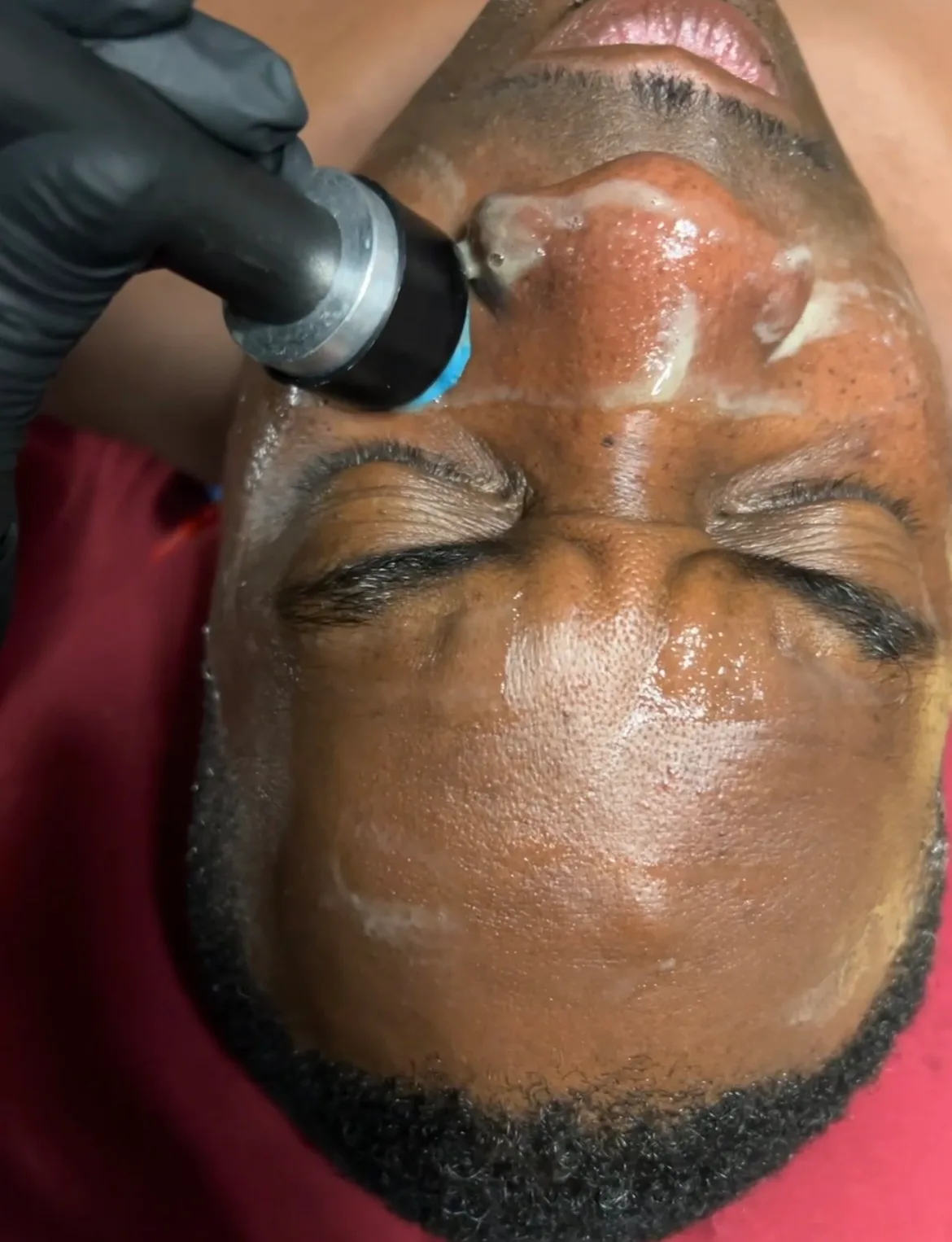 Galvanic Facial