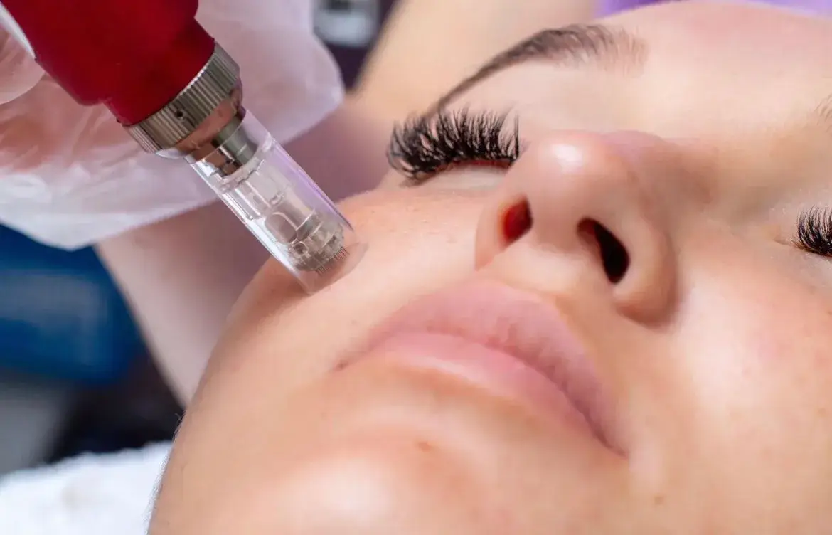Micro-Needling